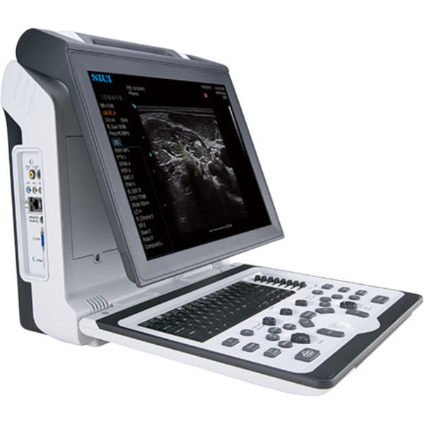 Finer.ua - Ультразвукова діагностична система APOGEE 2300